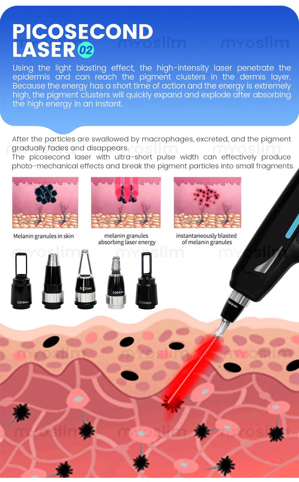 4 in 1 4000w Soprano Titanium Ice Platinum Diode 755 808 1064nm 4 Wavelength ND:YAG Laser Painless Hair Removal Machine
