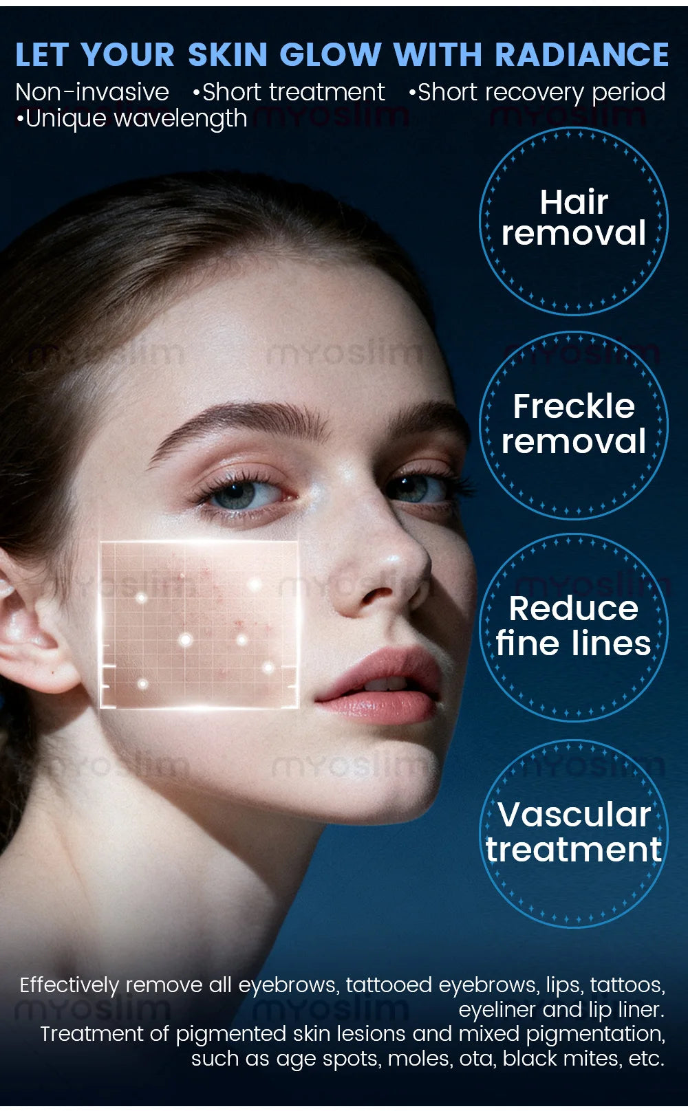 4 in 1 4000w Soprano Titanium Ice Platinum Diode 755 808 1064nm 4 Wavelength ND:YAG Laser Painless Hair Removal Machine