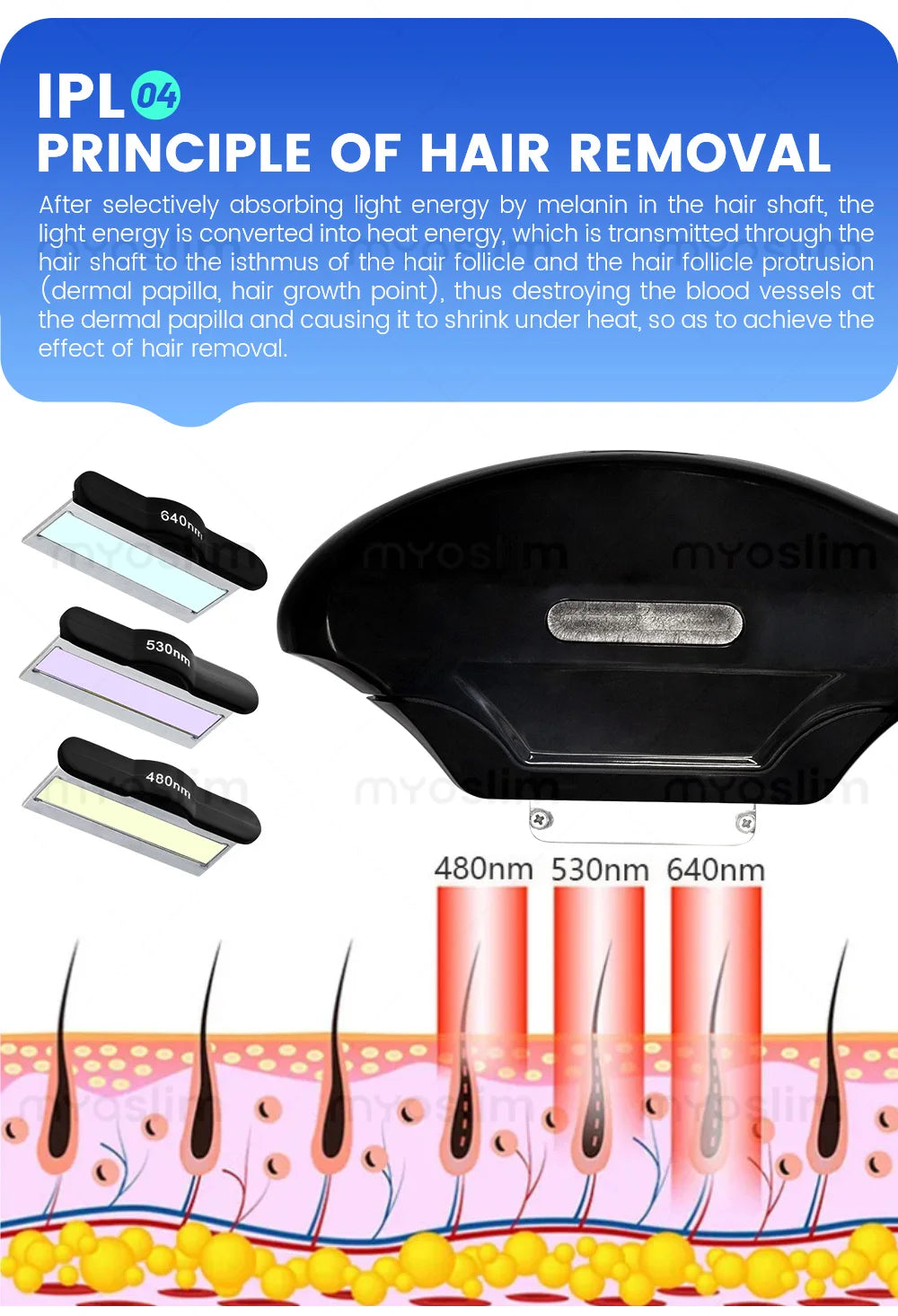 4 in 1 4000w Soprano Titanium Ice Platinum Diode 755 808 1064nm 4 Wavelength ND:YAG Laser Painless Hair Removal Machine